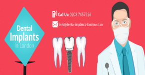 Dental Implants London Photo