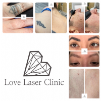 Love Laser Clinic Photo
